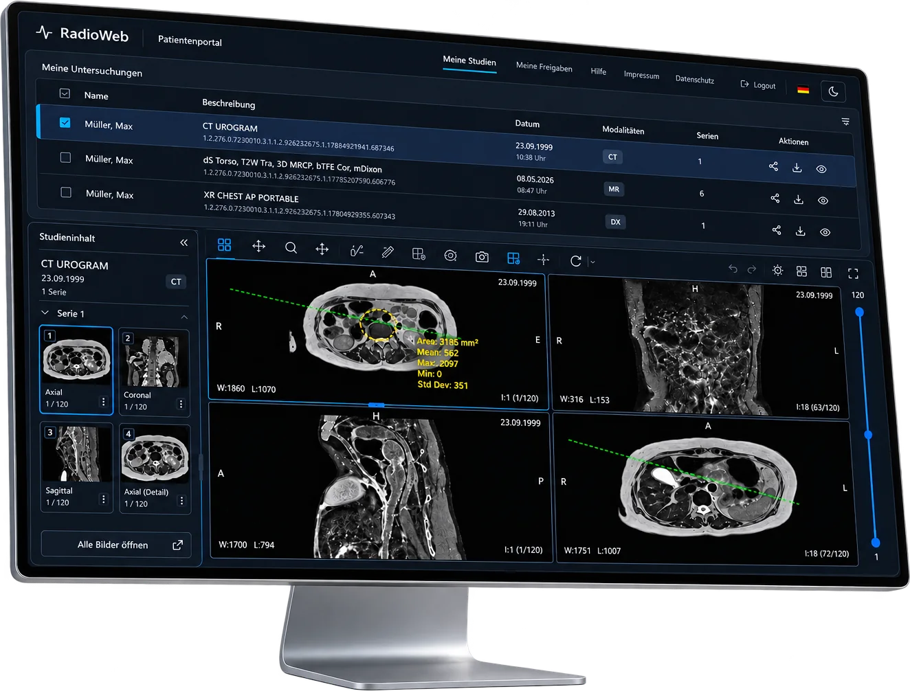 RadioWeb-Patientenportal auf einem Monitor: Studienliste und DICOM-Viewer mit CT-Untersuchung in vier Ansichten (Demodaten)